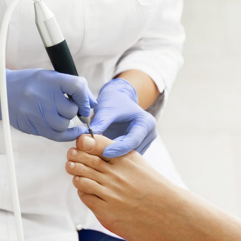 Medische of esthetische pedicure