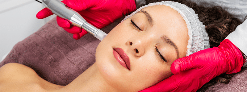 Vrouw doet een behandeling microneedling.